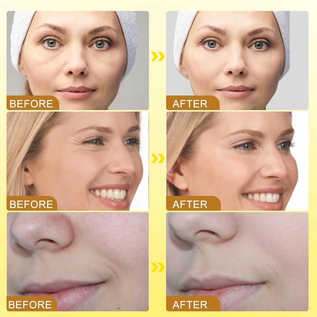 HiveGlow™ Skin Tightener