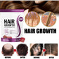 Force Factor™ -  Hair Growth Accelerator by Mosaic