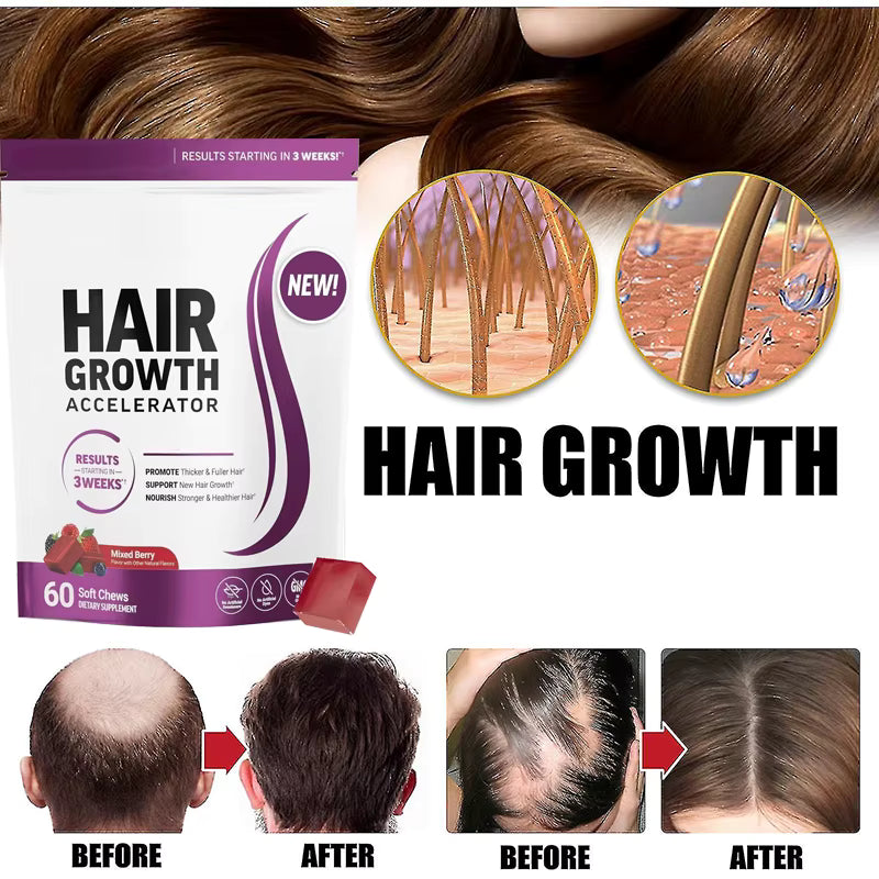 Force Factor™ -  Hair Growth Accelerator by Mosaic